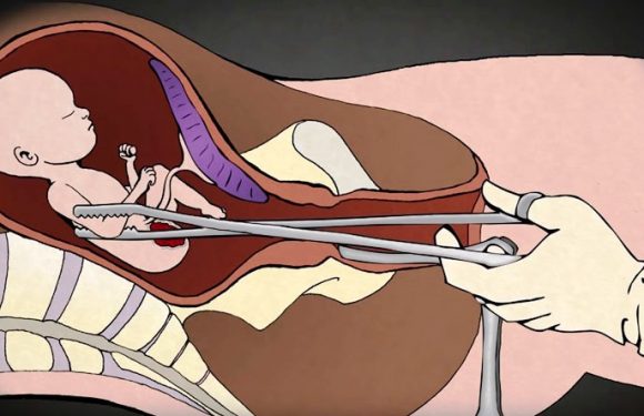 कञ्चनपुरमा सुरक्षित गर्भपतन गराउनेको संख्या बढ्दै