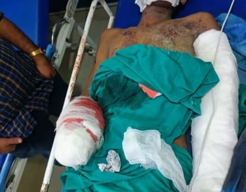 शिक्षकले विद्यार्थीलाई बिस्पोटक पदार्थ बनाउन प्रयोग बेदकोटका बैजनाथ माविका विद्यार्थी रुपेश गम्भिर घाईते